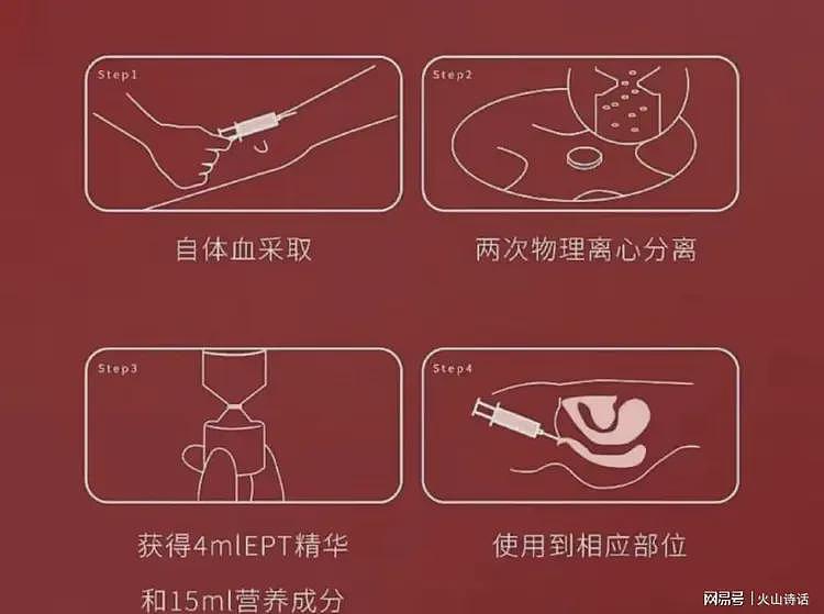 难以置信！珠海的“高潮针”火得离谱，好些宝妈都在排队等候注射（组图） - 7