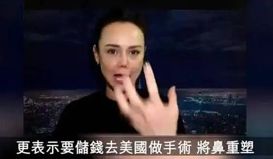 可惜了这张脸？越整越丑无奈退圈，恋女勾男惯三上瘾！今欠债破产乞讨为生？（组图） - 35