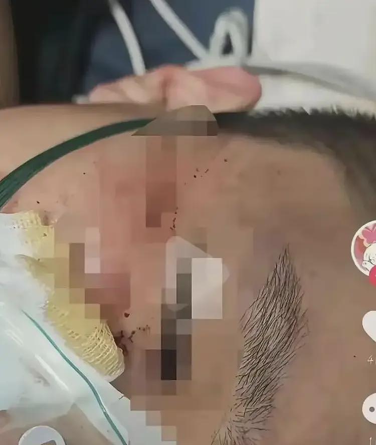 江西理工学生遭留学生群殴,夺手机锁喉踹肚子!网友批“崇洋媚外”(视频/组图) - 4