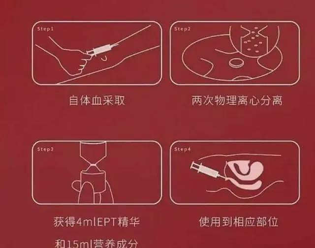 热搜上爆火的“高潮针”，背后的水真的很深……（组图） - 5