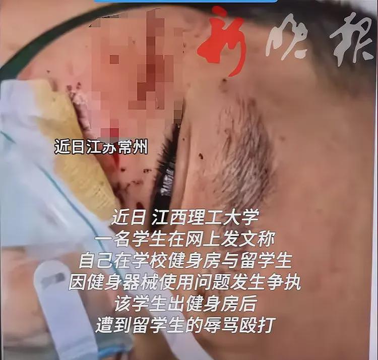 中国学生被打后续!曝留学生住双人间,领几万赞助,学校关评论(组图) - 6