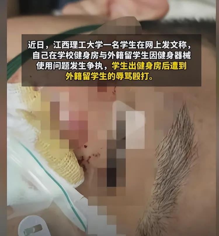 中国学生被打后续!曝留学生住双人间,领几万赞助,学校关评论(组图) - 1