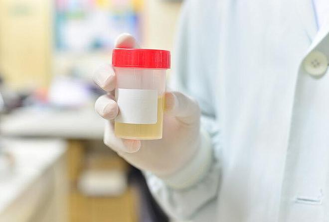 【涨知识】人活多久，看小便就知道？提醒：排尿时若有4个变化，应尽早检查（组图） - 3