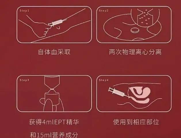 少妇们追着要打的高潮针!有人当场就湿了,千元起步疗程几万,真的有效果吗?(组图) - 10