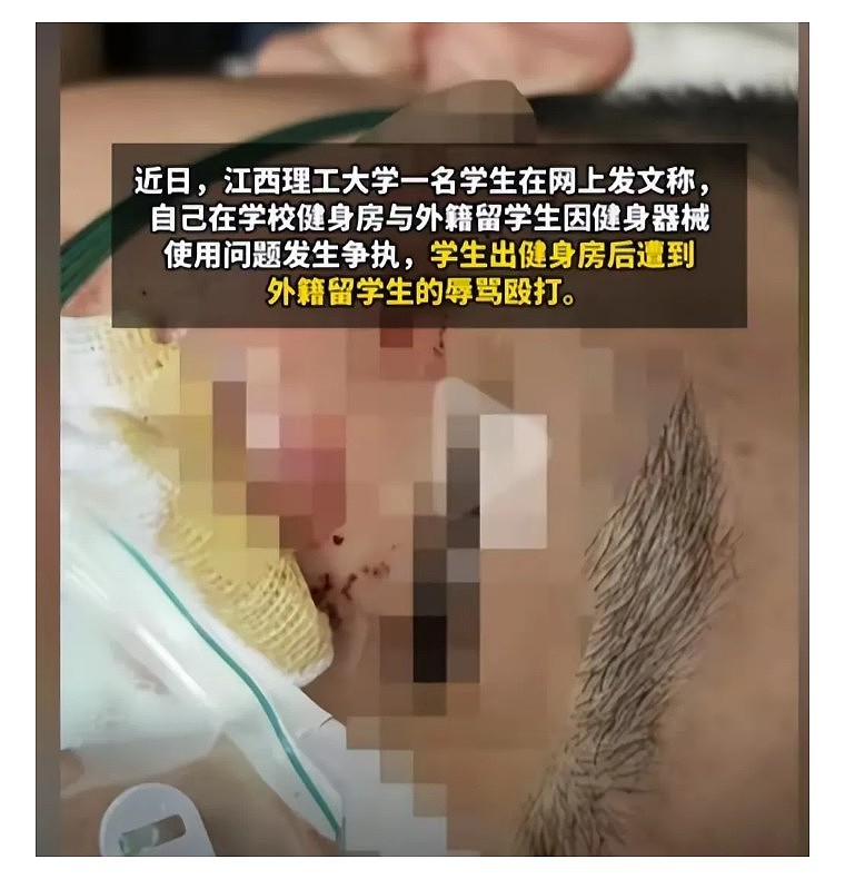 中国学生被留学生围殴最新进展!多部门已介入,学校关评论,火烧得更旺了(组图) - 23