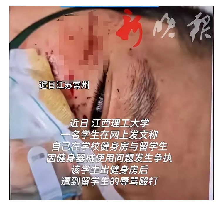 中国学生被留学生围殴最新进展!多部门已介入,学校关评论,火烧得更旺了(组图) - 9