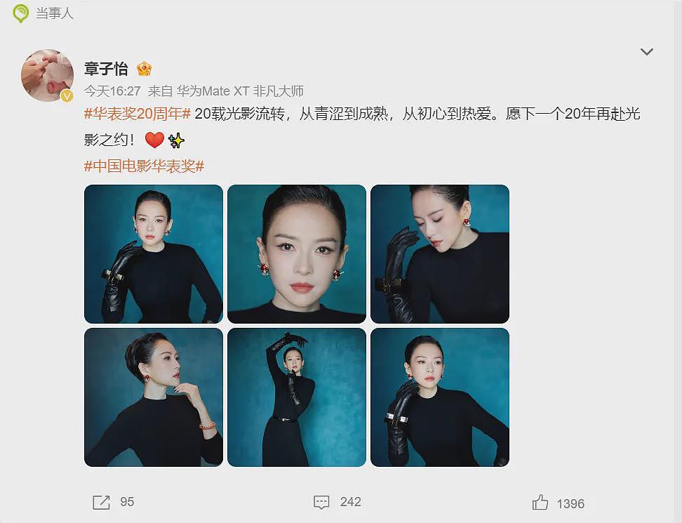 章子怡在华表奖意外摔倒,靠轮椅出行(组图) - 7