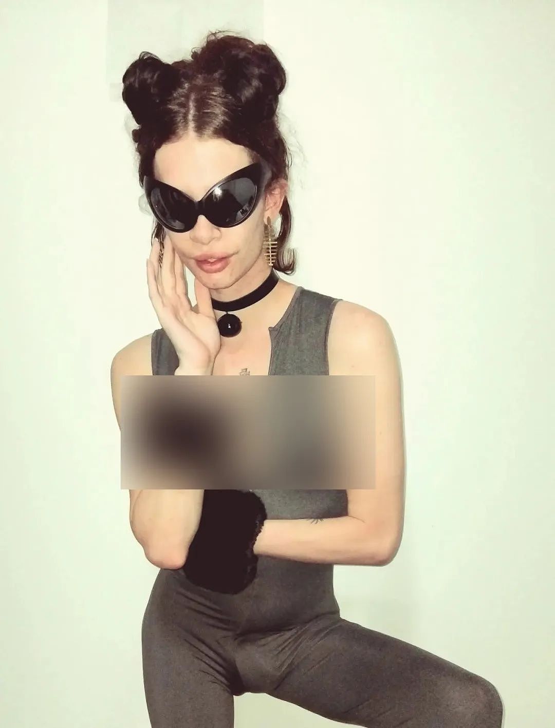 澳洲变性网红先变真人娃娃缝死肚脐，又整成猫女！如今一挤脸就流填充物，后悔了...（组图） - 9