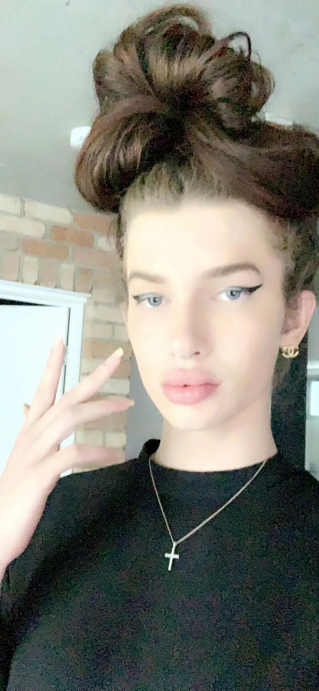 澳洲变性网红先变真人娃娃缝死肚脐，又整成猫女！如今一挤脸就流填充物，后悔了...（组图） - 7