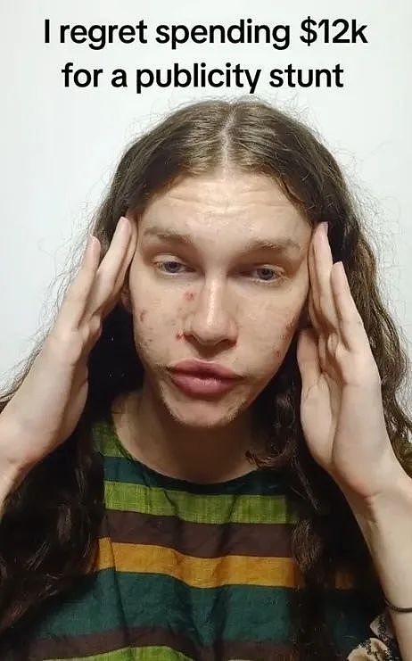 澳洲变性网红先变真人娃娃缝死肚脐，又整成猫女！如今一挤脸就流填充物，后悔了...（组图） - 11
