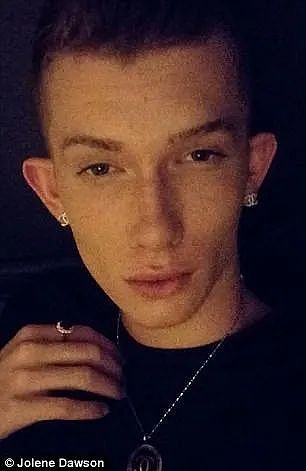 澳洲变性网红先变真人娃娃缝死肚脐，又整成猫女！如今一挤脸就流填充物，后悔了...（组图） - 5