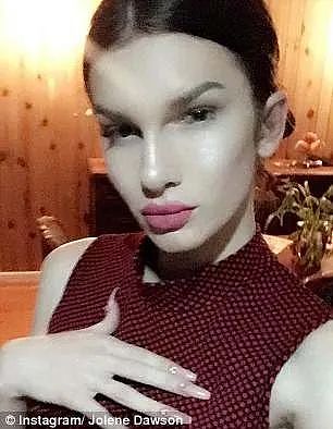 澳洲变性网红先变真人娃娃缝死肚脐，又整成猫女！如今一挤脸就流填充物，后悔了...（组图） - 3