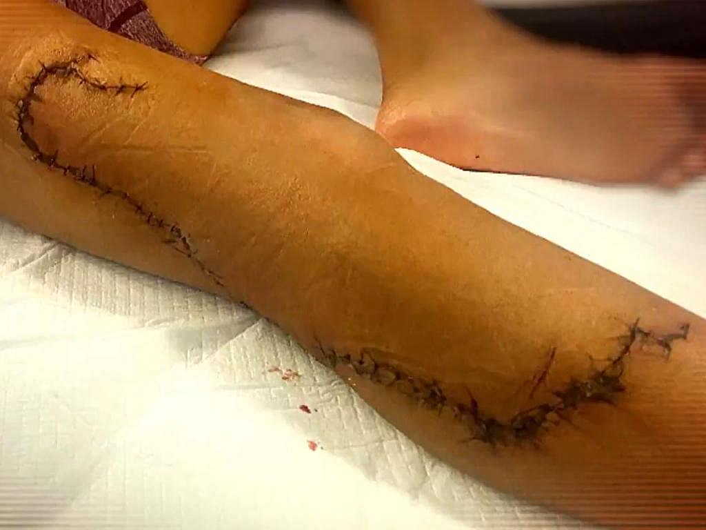 不停流血，以为自己要死了！澳洲华人突遭不测，路人英勇相救！（组图） - 6