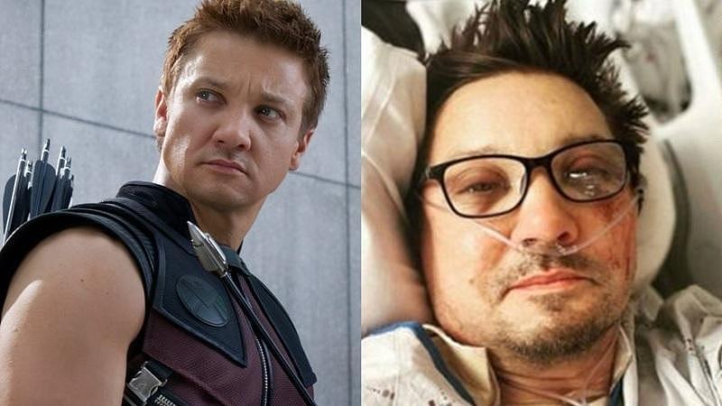 鹰眼男星昔遭铲雪车重辗，肋骨断30根、眼球爆出（组图） - 1