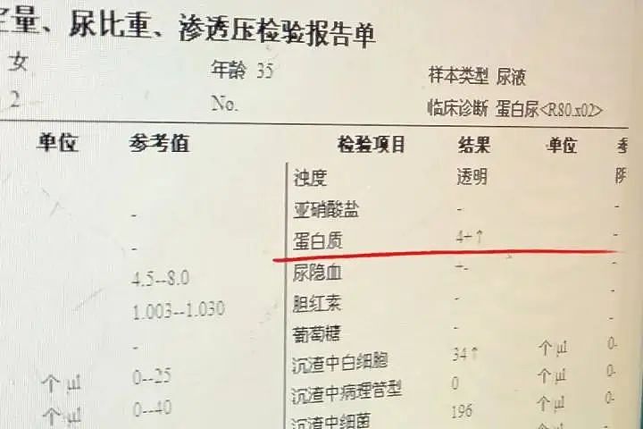 姐妹俩双双中毒送医,只因用了同款面霜(组图) - 1