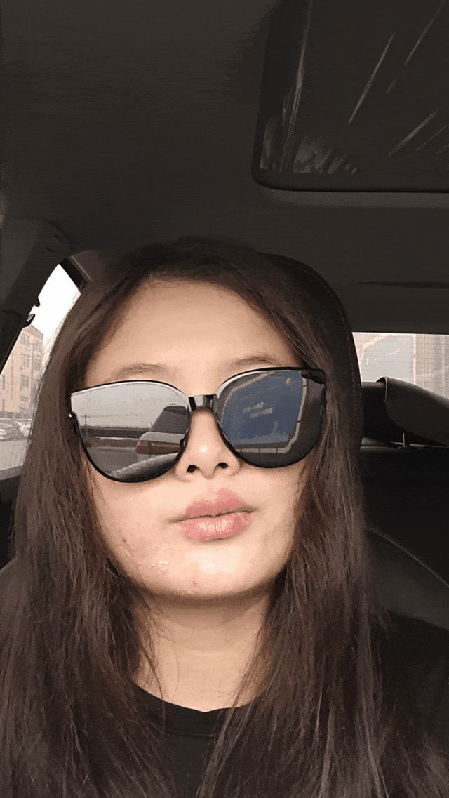中国妹纸发视频引中美网友一片惊恐！就因KTV唱歌话筒太靠近脸，她从此染上“不治之症”8年后仍被折磨（组图） - 4