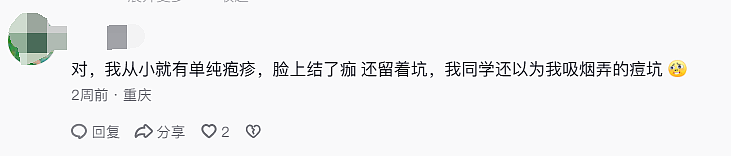 中国妹纸发视频引中美网友一片惊恐！就因KTV唱歌话筒太靠近脸，她从此染上“不治之症”8年后仍被折磨（组图） - 24