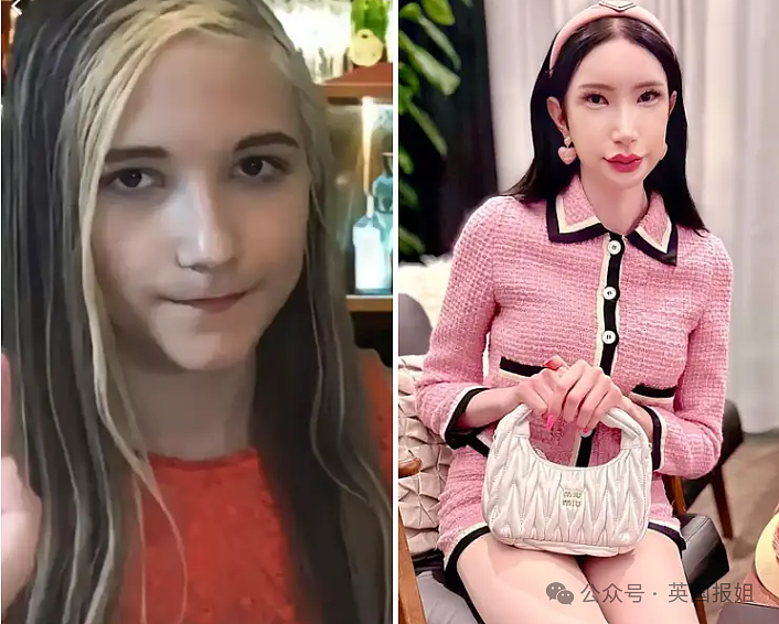 奥地利白女网红梦想当韩国美女,竟全脸爆改缝单眼皮整成塑料人?网友:看着都渗人(组图) - 3