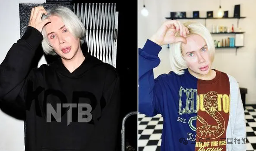 奥地利白女网红梦想当韩国美女,竟全脸爆改缝单眼皮整成塑料人?网友:看着都渗人(组图) - 40