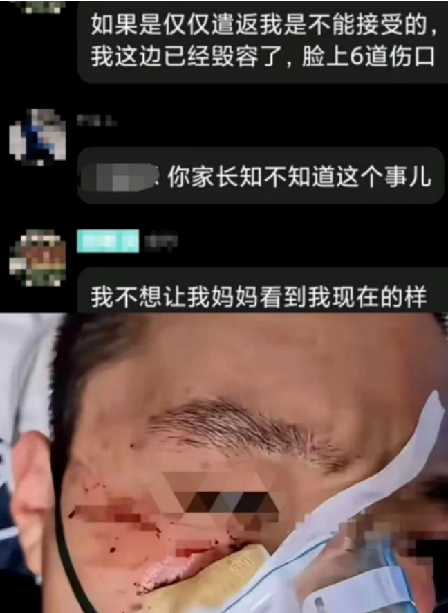 后续!中国学生遭留学生群殴!施暴者身份曝光引争议,被打男生恐毁容...(组图) - 9