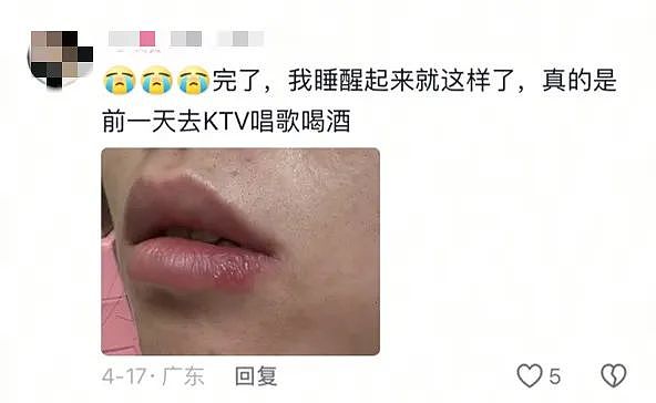 中国妹纸发视频引中美网友一片惊恐！就因KTV唱歌话筒太靠近脸，她从此染上“不治之症”8年后仍被折磨（组图） - 19