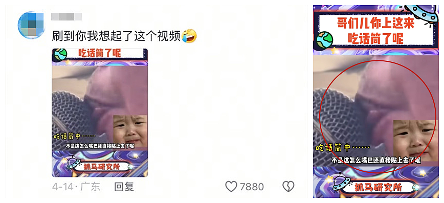中国妹纸发视频引中美网友一片惊恐！就因KTV唱歌话筒太靠近脸，她从此染上“不治之症”8年后仍被折磨（组图） - 11