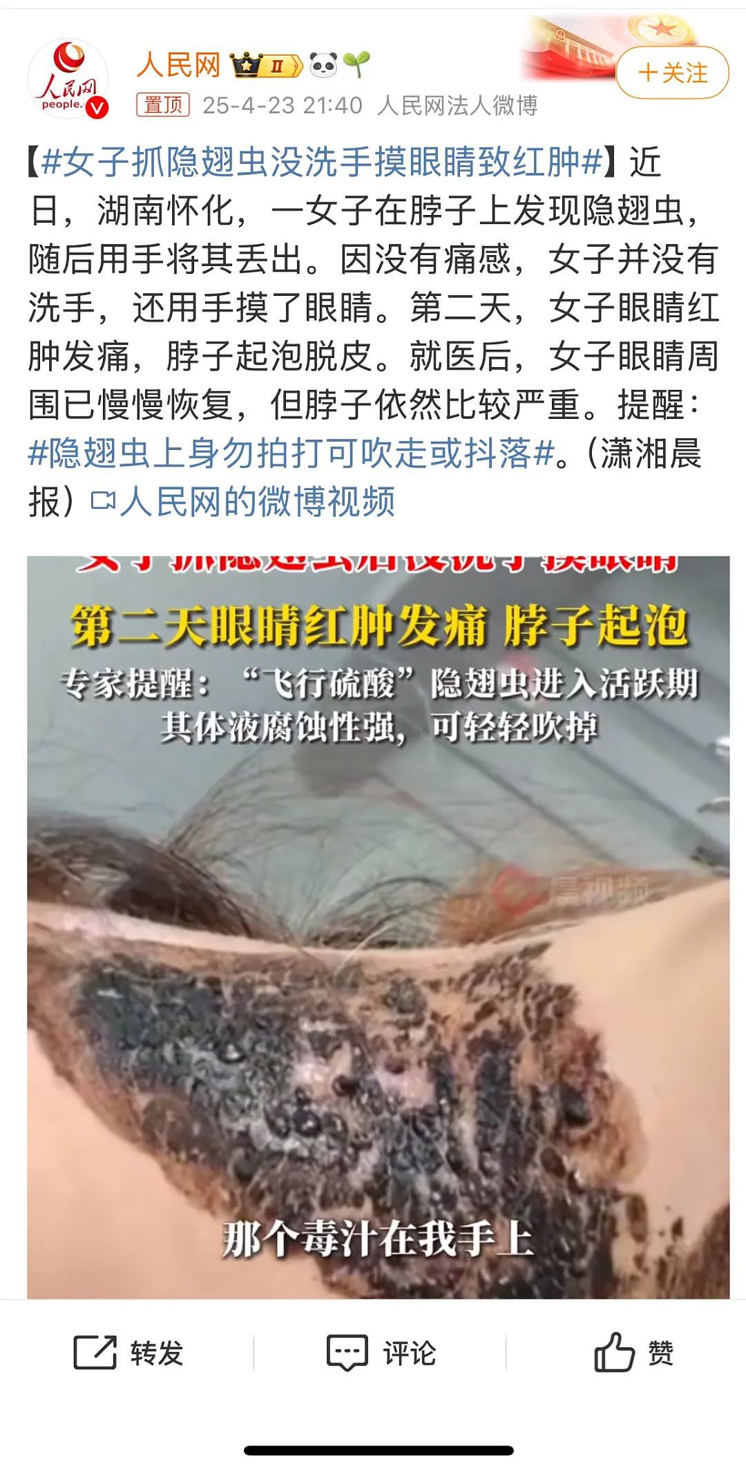 有人因此“毁容”!近期这种虫子很活跃,遇到千万不能拍!正确应对只需一招(组图) - 1