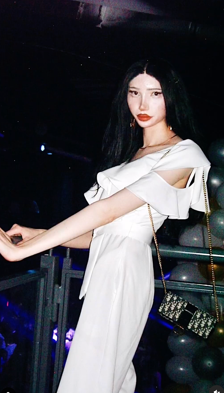 混血女网红因从小饱受霸凌，痴迷整容全脸爆改，网友：太渗人...（组图） - 6