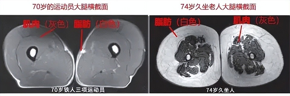 运动是加速衰老，还是延缓衰老？真相被揭开：我们被骗了好多年（组图） - 5
