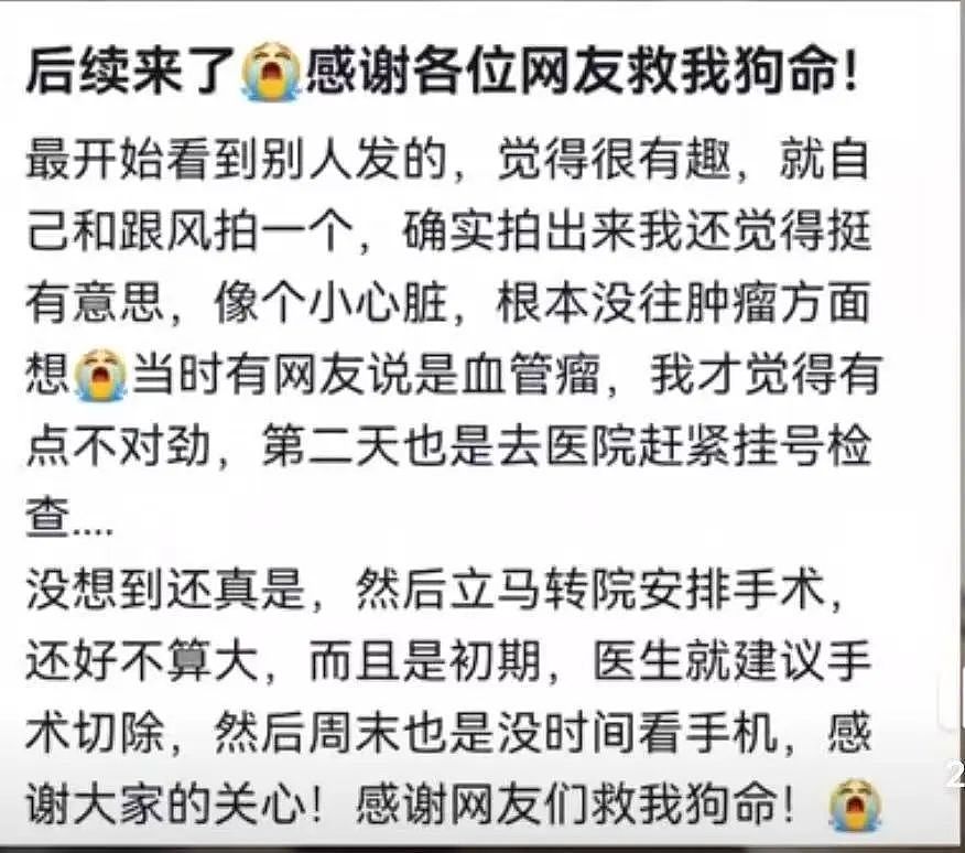 女生拿手电筒照手，网友发现不对劲！医生：这些危险信号要当心…（组图） - 5