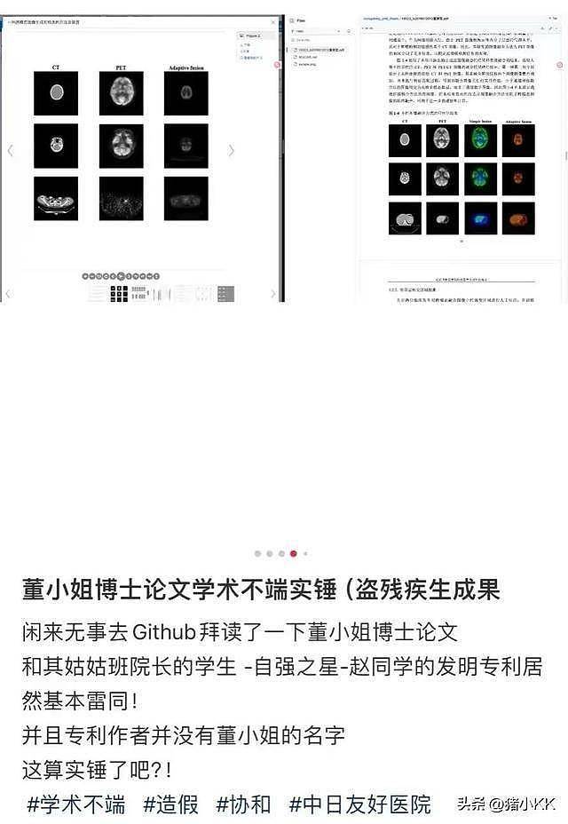董小姐整容前照片被曝:长相一般,脸盘子大(组图) - 24