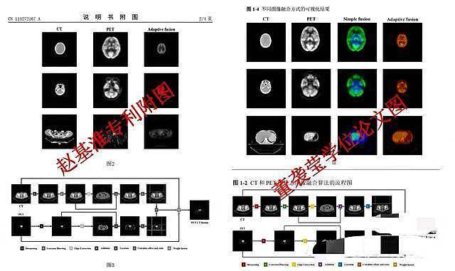 董小姐整容前照片被曝:长相一般,脸盘子大(组图) - 9