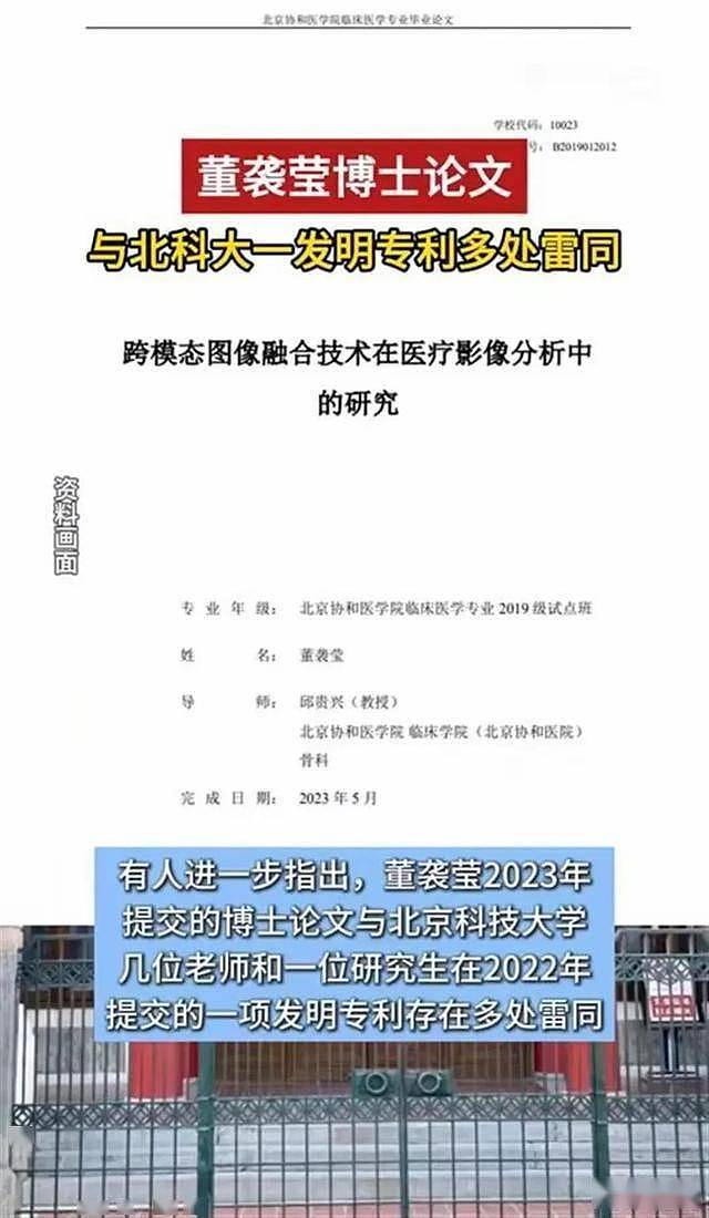 董小姐整容前照片被曝:长相一般,脸盘子大(组图) - 13