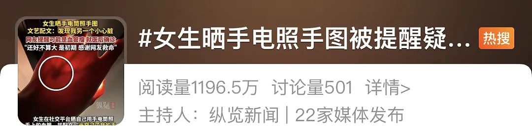 女生拿手电筒照手，网友发现不对劲！医生：这些危险信号要当心…（组图） - 1