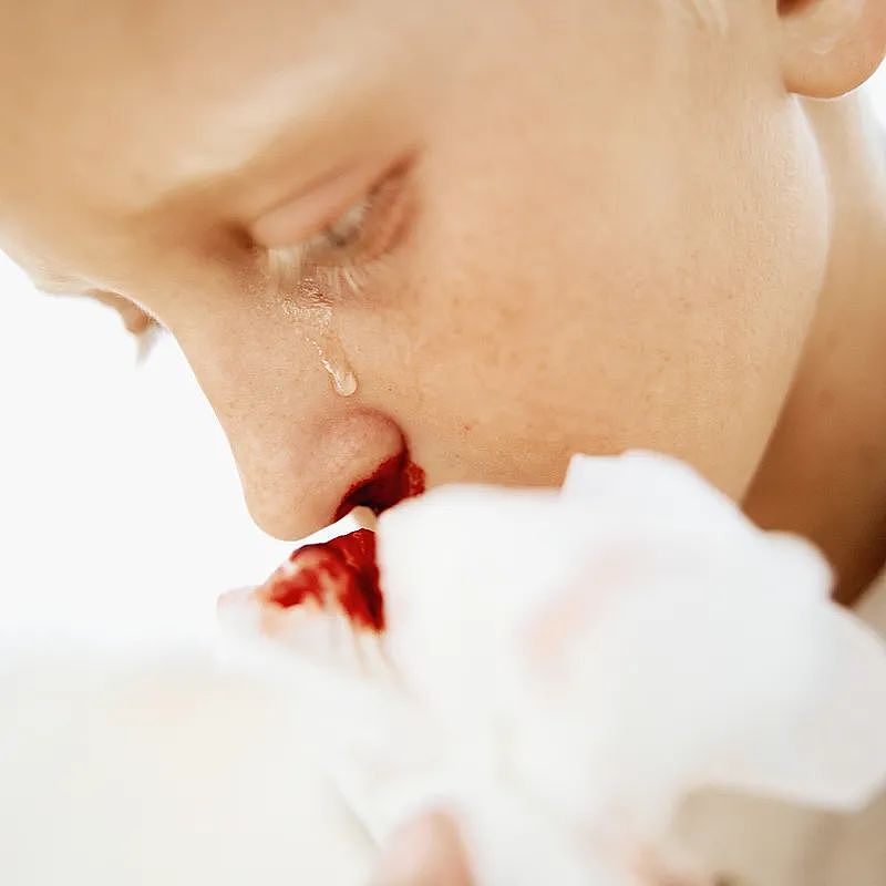女生拿手电筒照手，网友发现不对劲！医生：这些危险信号要当心…（组图） - 9