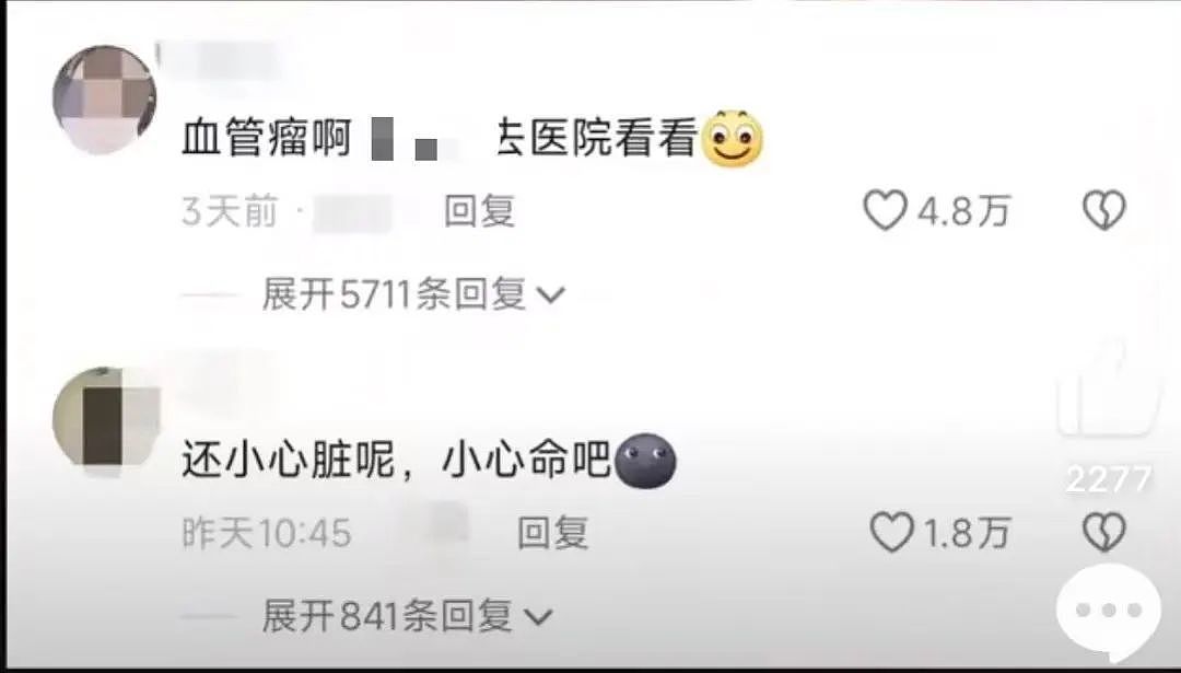 女生拿手电筒照手，网友发现不对劲！医生：这些危险信号要当心…（组图） - 3