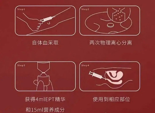 上热搜的“高潮针”，到底让谁“高潮”？（组图） - 2