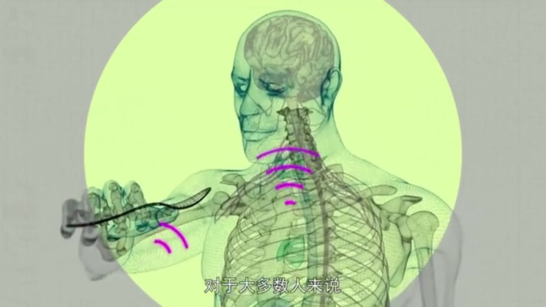 以为少吃就能瘦？BBC纪录片扎心揭秘：人胖分3种，有些人节食根本瘦不下来（组图） - 58