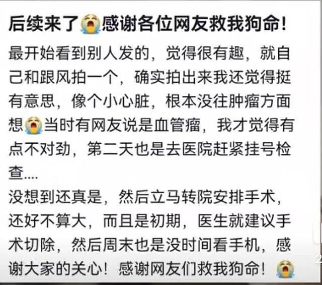 女生晒电筒照手图被网友发现不对劲！检查后确诊血管瘤立马住院手术，医生：这些危险信号要当心（组图） - 4