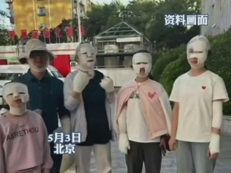五一7人烧烤被炸伤后续：现场画面惨不忍睹，原因曝光家长要谨慎（组图） - 1