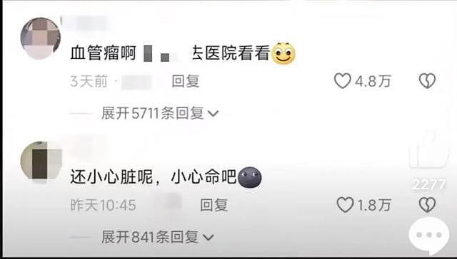 女生晒电筒照手图被网友发现不对劲！检查后确诊血管瘤立马住院手术，医生：这些危险信号要当心（组图） - 2