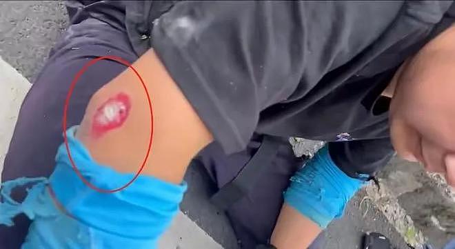全网愤怒！宁波保时捷弯道超车撞飞摩托车，肇事者不救人先换车牌！警方通报引争议（视频/组图） - 7