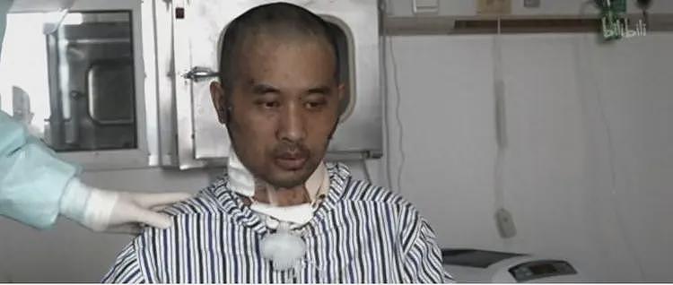 全身溃烂生不如死,丧失生育功能,武汉首批新冠患者如今结局如何(组图) - 8