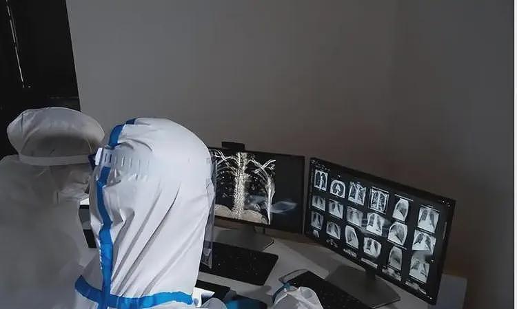 全身溃烂生不如死,丧失生育功能,武汉首批新冠患者如今结局如何(组图) - 25