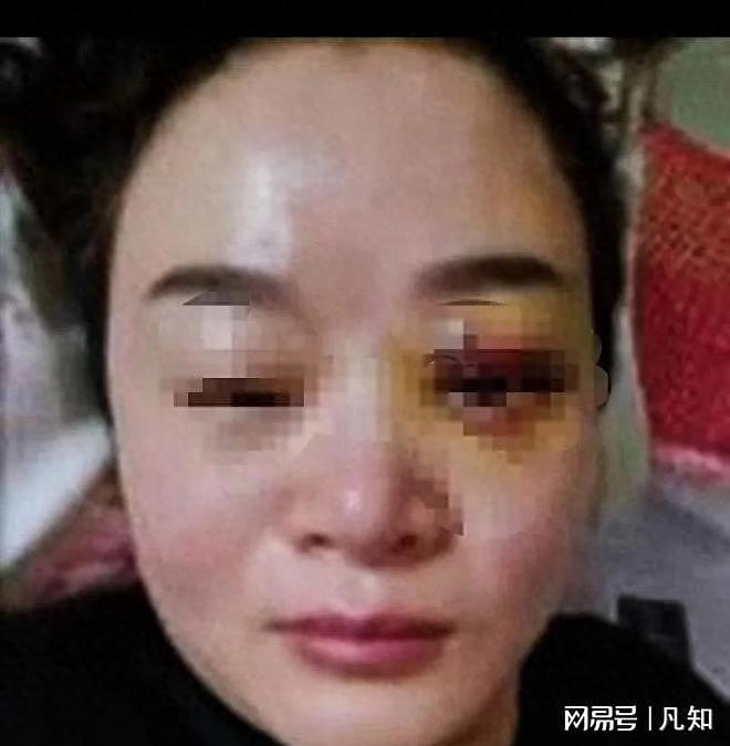 郑州女子曝知名企业家常年家暴：被迫喝尿、发生关系，四个月流产两次（组图） - 1