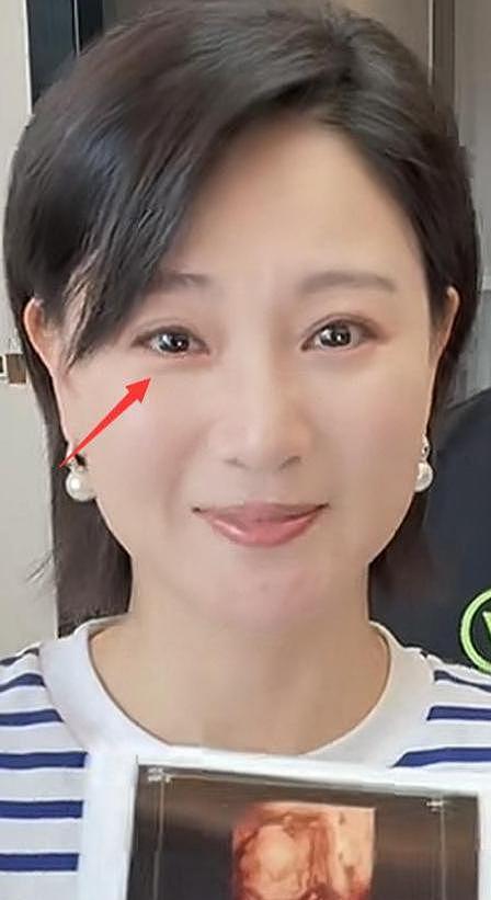 40岁演员侯梦莎官宣怀孕！晒孕肚照激动落泪，结婚四年备孕艰辛（组图） - 9