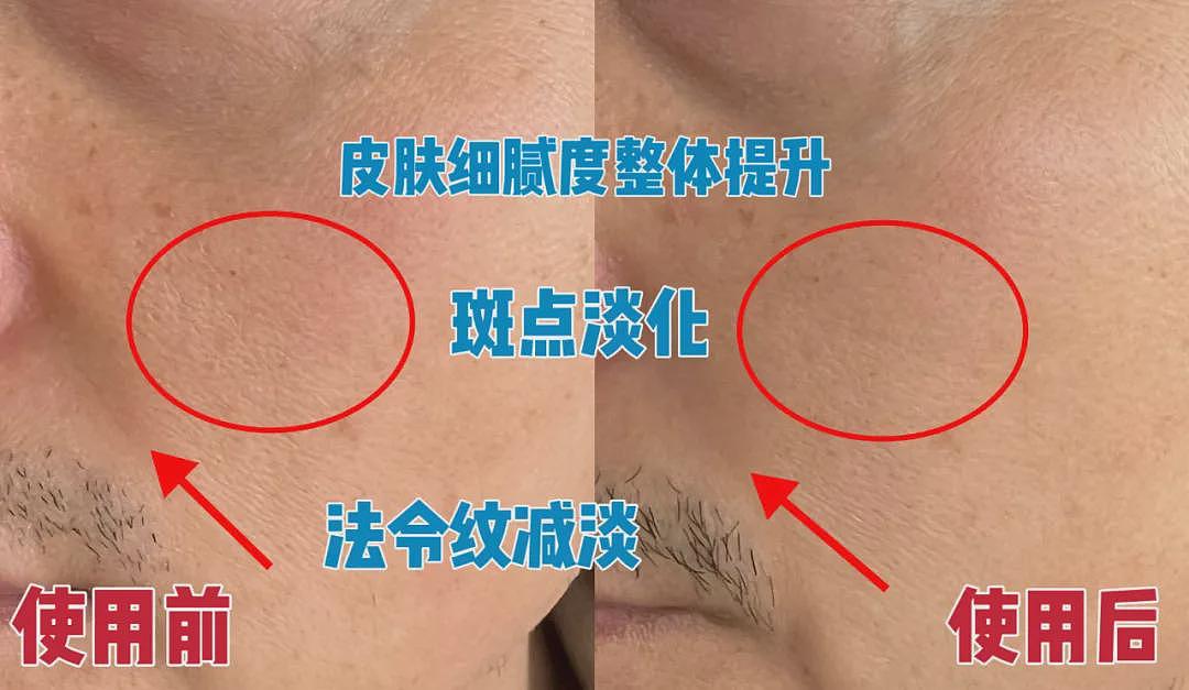 几大【祛皱利器】对比分析：选对了，让你事半功倍！（组图） - 9