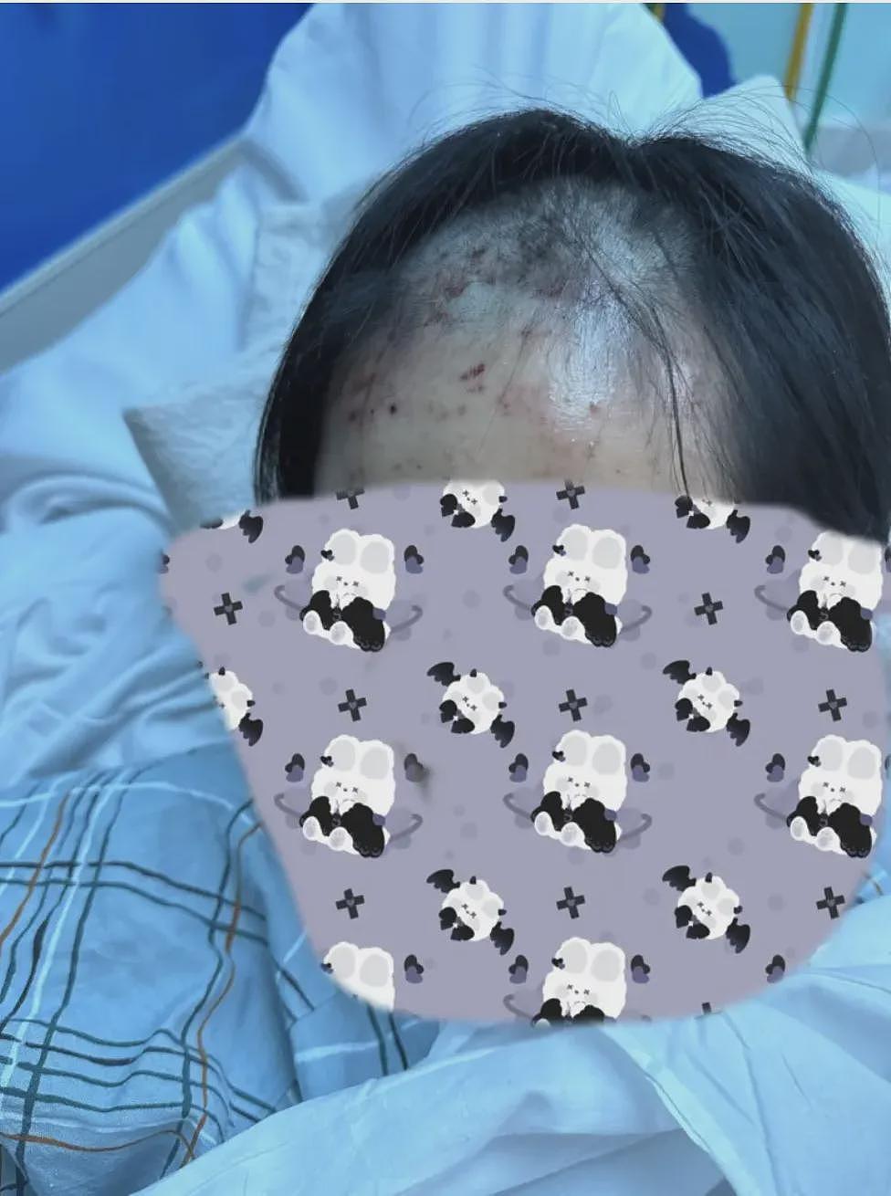 炸了！2华裔少女被同族围殴2小时！铁棍狠砸、剃头掐脖！如同私刑（组图） - 2