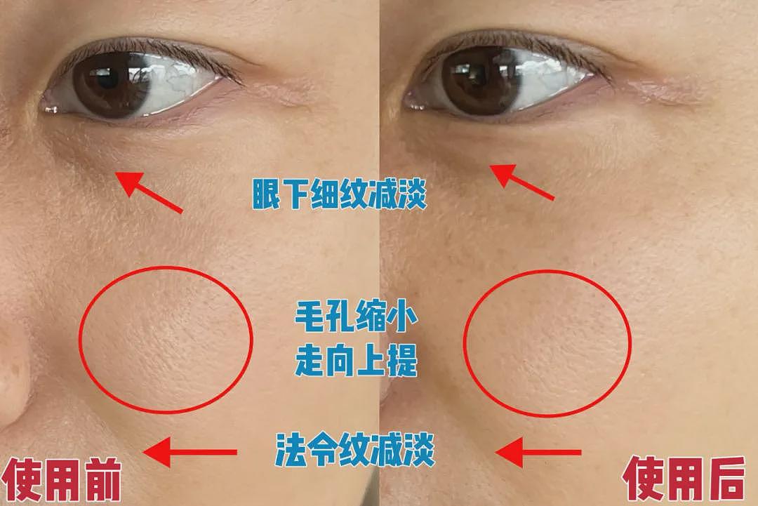 几大【祛皱利器】对比分析：选对了，让你事半功倍！（组图） - 8