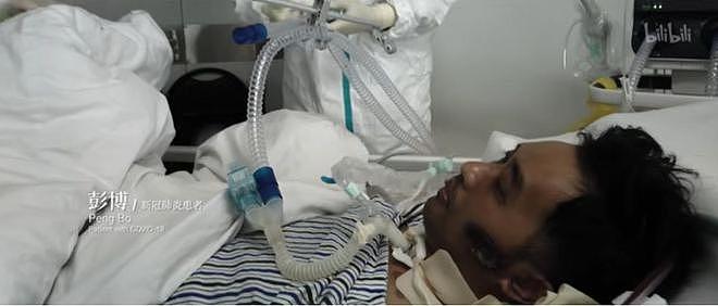 全身溃烂生不如死，丧失生育功能，武汉首批新冠患者如今结局如何（组图） - 16